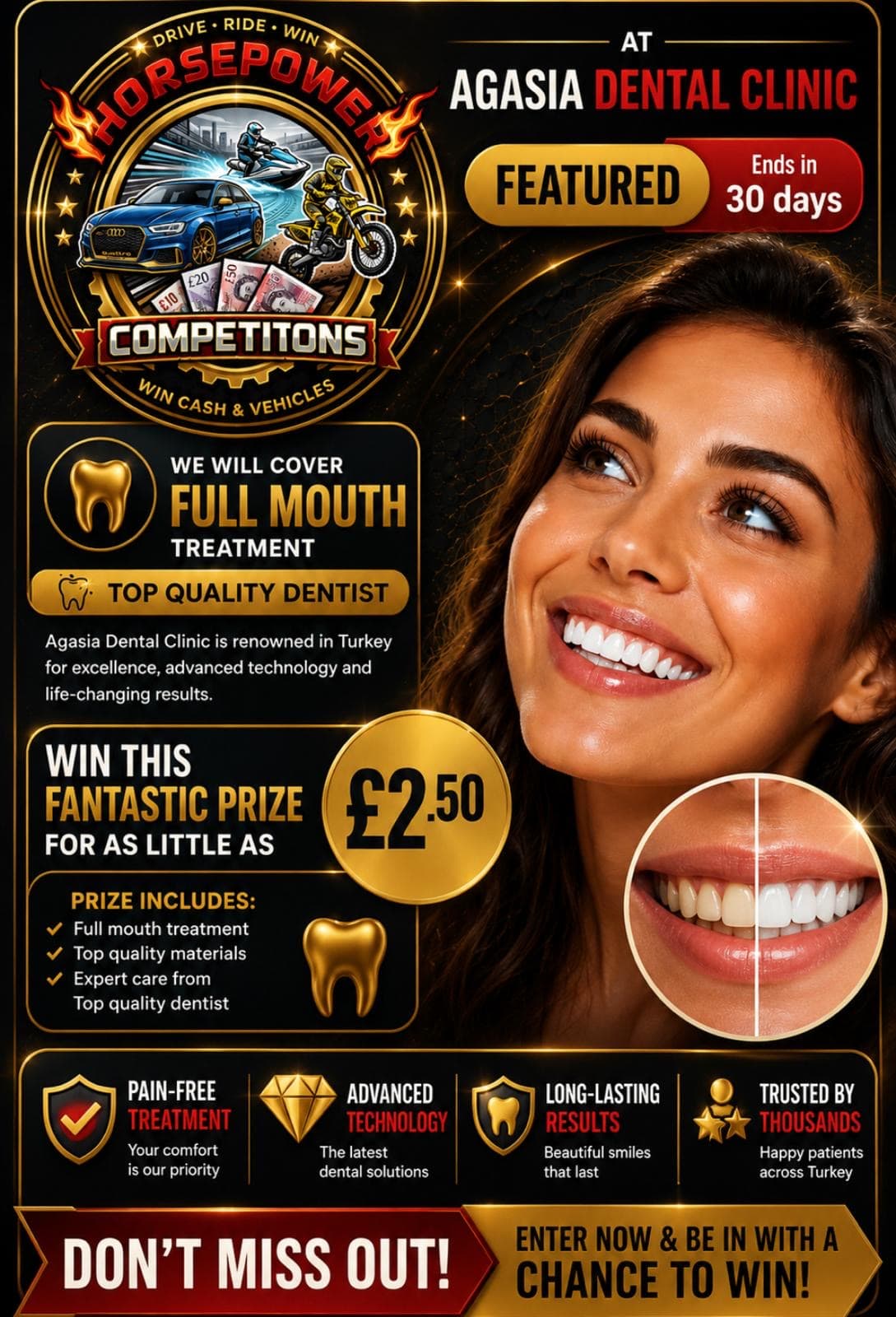 Smile Makeover in Antalya